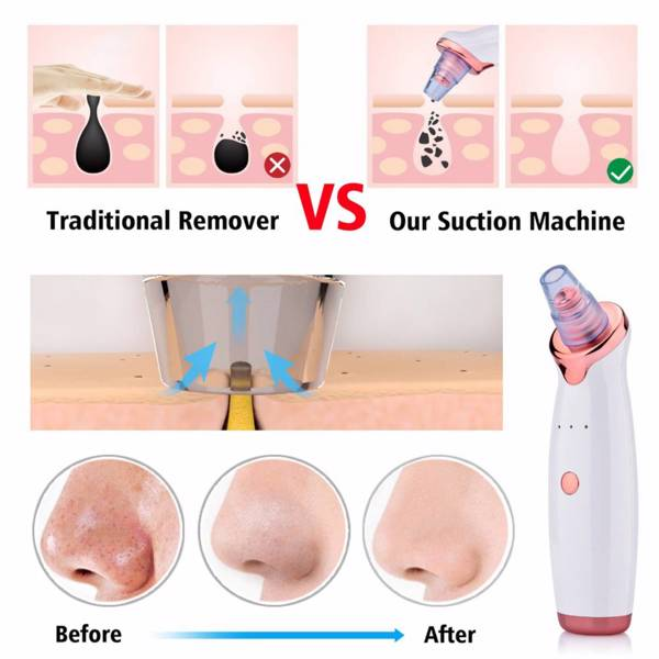 Electric Skin blackhead Vacuum Facial Blackhead Remover